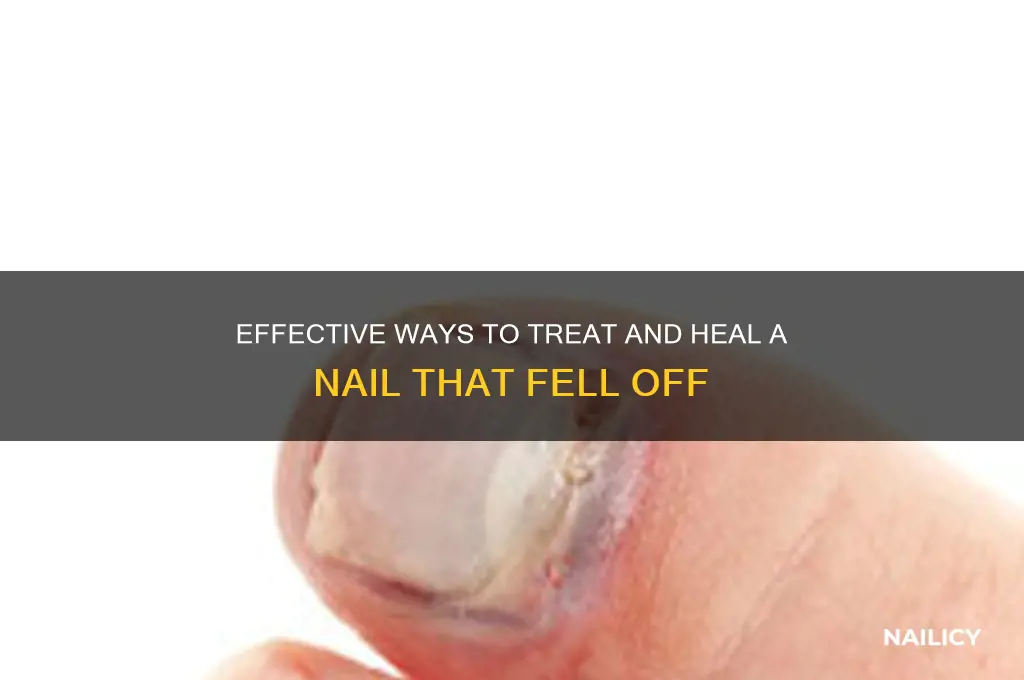 how to treat a nail that fell off