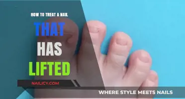 Effective Ways to Treat and Repair a Lifted Nail Safely
