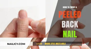 Healing a Peeled Back Nail: Quick and Effective Treatment Tips