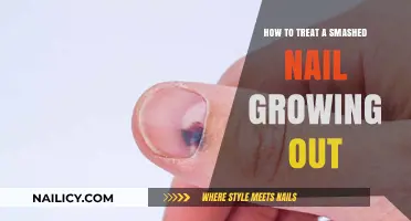 Treating a Smashed Nail: Tips for Healthy Regrowth