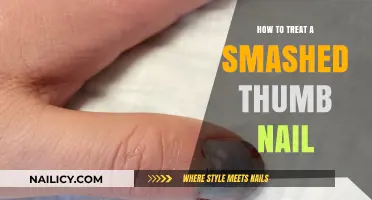 Quick Relief: Treating a Smashed Thumb Nail Effectively at Home