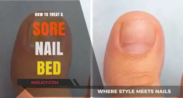 Effective Remedies for Treating Sore Nail Beds: A Comprehensive Guide