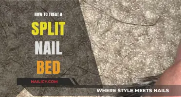 Effective Home Remedies for Healing and Treating a Split Nail Bed