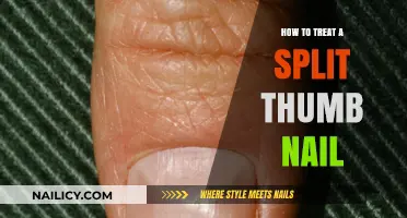 Quick Fixes for Split Thumb Nails: Healing and Prevention Tips