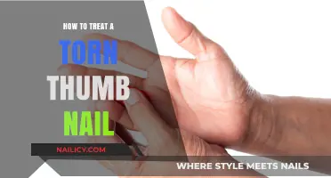 Quick Fixes and Care Tips for Treating a Torn Thumb Nail
