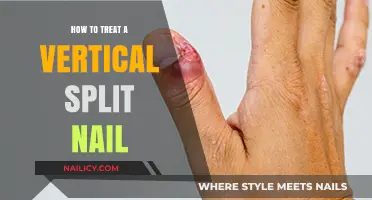 Heal and Prevent Vertical Split Nails: Effective Treatment Tips