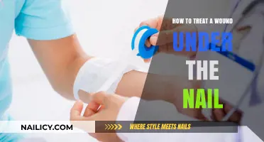 Effective Ways to Treat and Heal a Painful Nail Wound