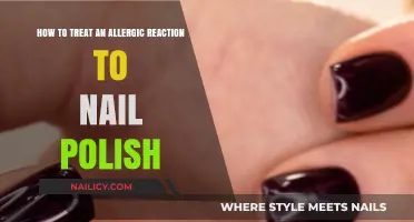 Treating Nail Polish Allergies: Quick Relief and Prevention Tips