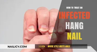 Treating Infected Hangnails: Quick Remedies and Prevention Tips