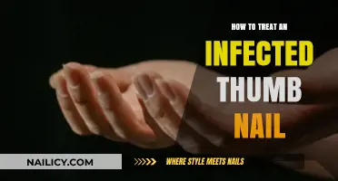 Effective Home Remedies and Medical Treatments for Infected Thumb Nail Relief