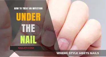 Effective Treatment for Painful Nail Infections: A Comprehensive Guide