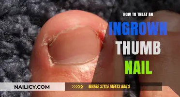 Effective Remedies for Treating Painful Ingrown Thumb Nails at Home