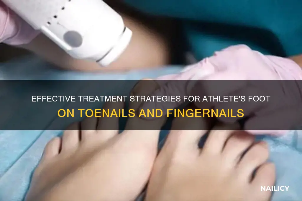 how to treat athlete