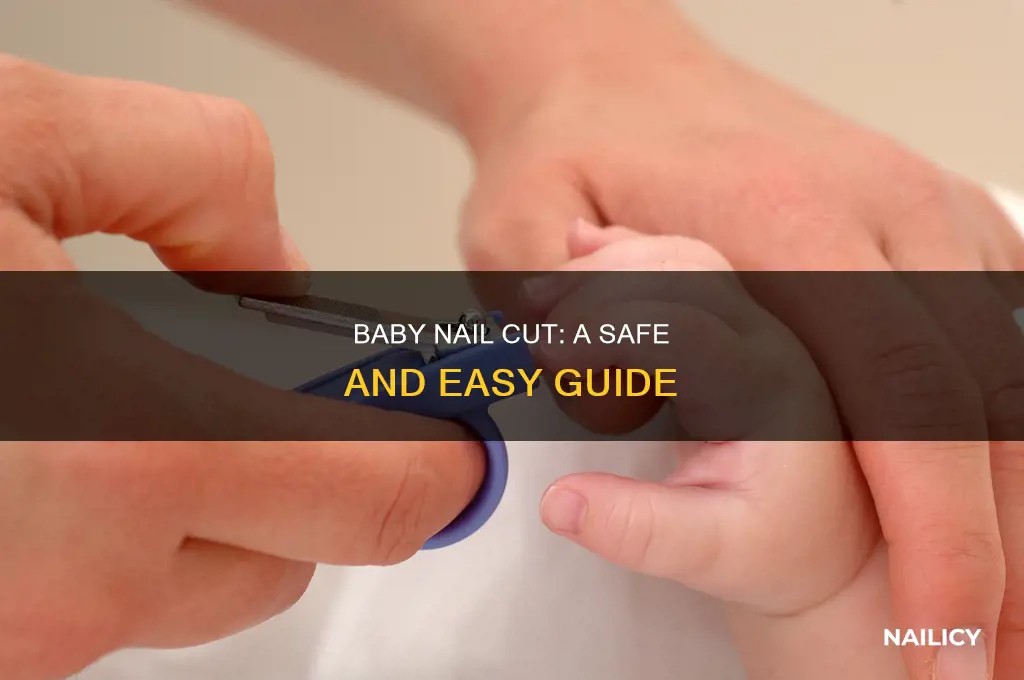 how to treat baby nail cut