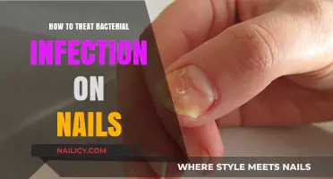 Effective Treatments for Bacterial Nail Infections: A Comprehensive Guide