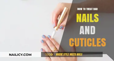 Revive Your Nails: Effective Treatments for Healthy Cuticles and Strong Nails