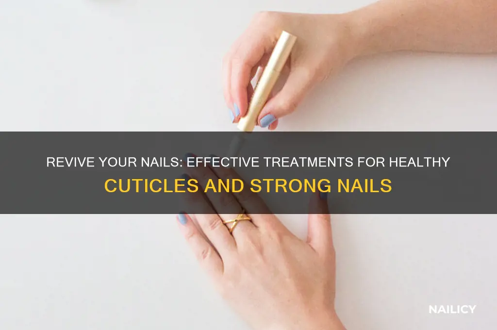 how to treat bad nails and cuticles