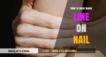 Treating Black Lines on Nails: Causes, Remedies, and Prevention Tips