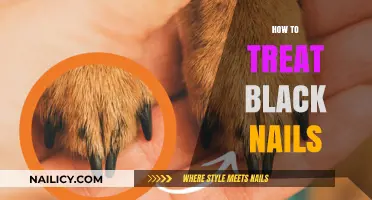 Effective Remedies for Treating Black Nails: Causes, Prevention, and Care Tips