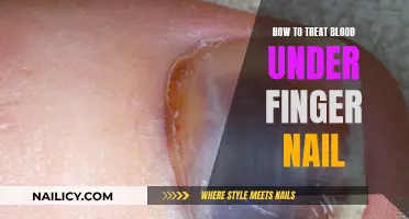 Treating Blood Under Fingernails: Quick and Effective Home Remedies