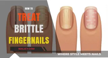 Strengthen Brittle Fingernails: Effective Treatments and Care Tips Revealed