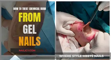 Treating Chemical Burns from Gel Nails: First Aid Essentials