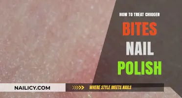 Effective Chigger Bite Relief: Using Nail Polish as a Home Remedy