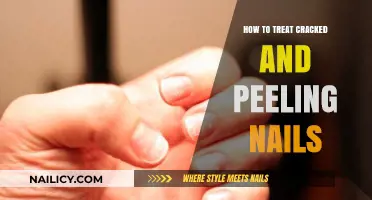Effective Remedies for Healing Cracked and Peeling Nails Naturally