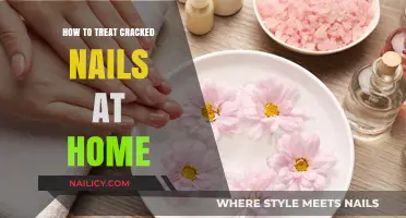 Effective Home Remedies to Repair and Strengthen Cracked Nails Fast