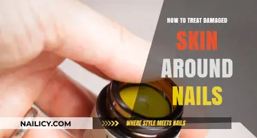 Heal and Restore: Effective Treatments for Damaged Skin Around Nails