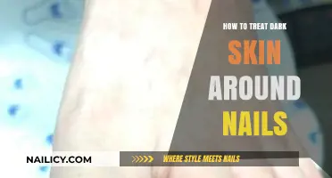 Treating Dark Skin Around Nails: Effective Remedies and Prevention Tips