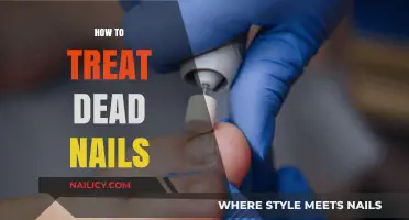 Revive Your Dead Nails: Effective Treatment Tips for Healthy Growth