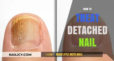 Effective Ways to Treat and Heal a Detached Nail at Home