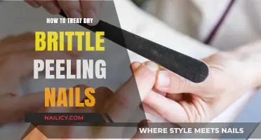 Revive Dry, Brittle, Peeling Nails: Effective Treatments and Care Tips