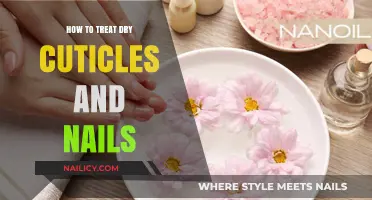 Nourish and Repair: Effective Treatments for Dry Cuticles and Nails
