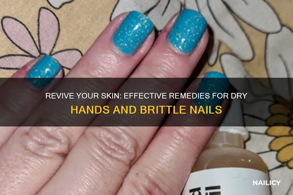 how to treat dry hands and nails