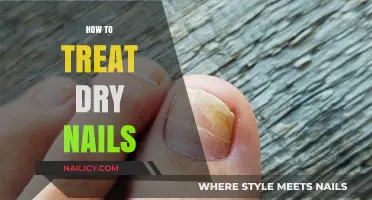 Effective Remedies for Dry Nails: Hydration and Care Tips