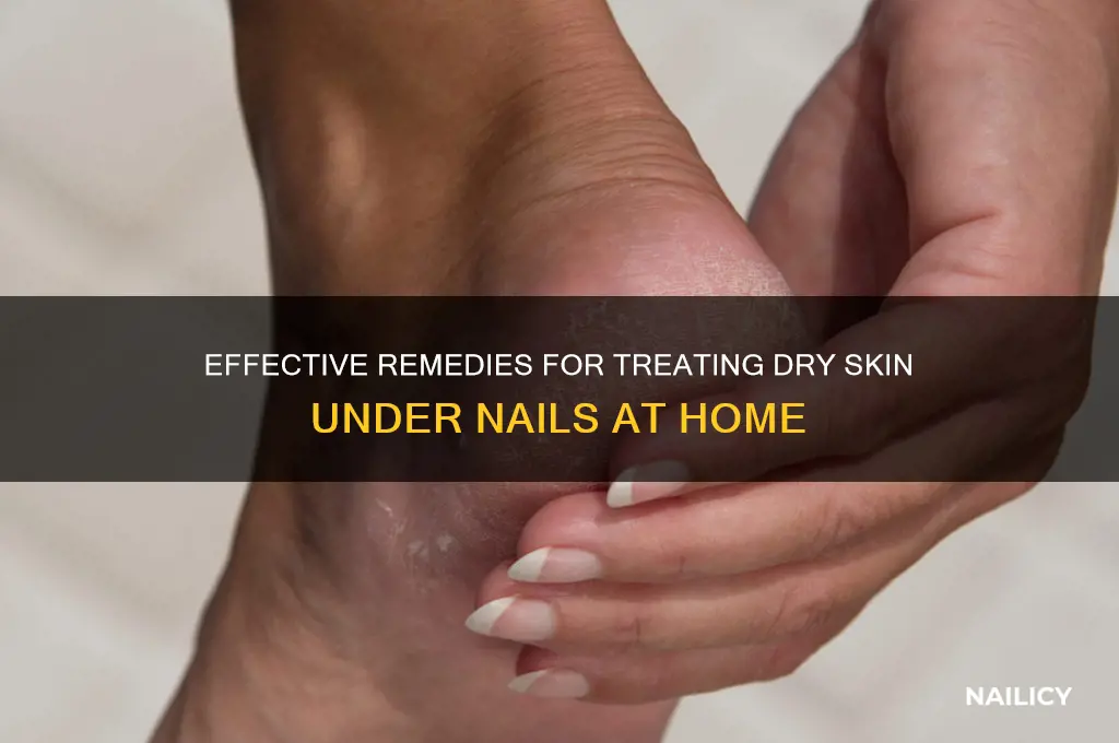 how to treat dry skin under nails