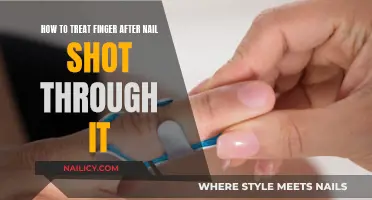 Treating Finger Injuries: When Nails Go Through
