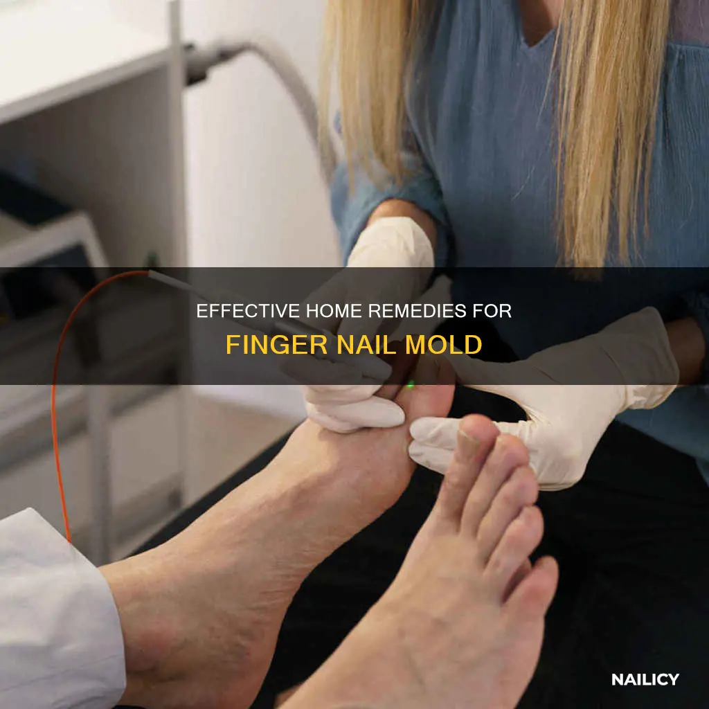 how to treat finger nail mold