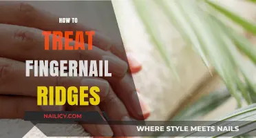 Effective Ways to Smooth and Treat Fingernail Ridges Naturally