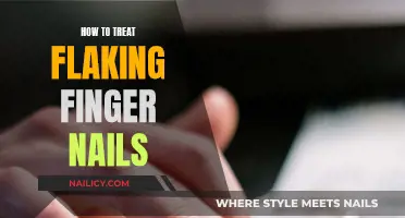 Treating Flaky Fingernails: A Simple Guide to Healthy Nails