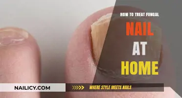 Effective Home Remedies for Treating Fungal Nail Infections Naturally
