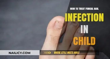 Effective Treatment Options for Childhood Fungal Nail Infections: A Parent's Guide