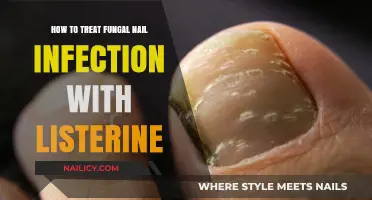 Effective Listerine Treatment for Fungal Nail Infections: A Simple Guide