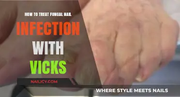 Effective Vicks Vaporub Treatment for Fungal Nail Infections: A Guide