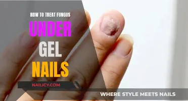 Treating Fungus Under Gel Nails: Expert Tips and Tricks