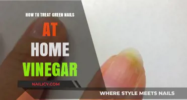 Treating Green Nails at Home: Vinegar Remedies for Healthy Nails