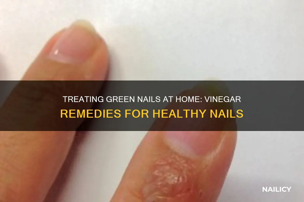 how to treat green nails at home vinegar