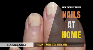Effective Home Remedies to Treat Green Nails Naturally and Safely